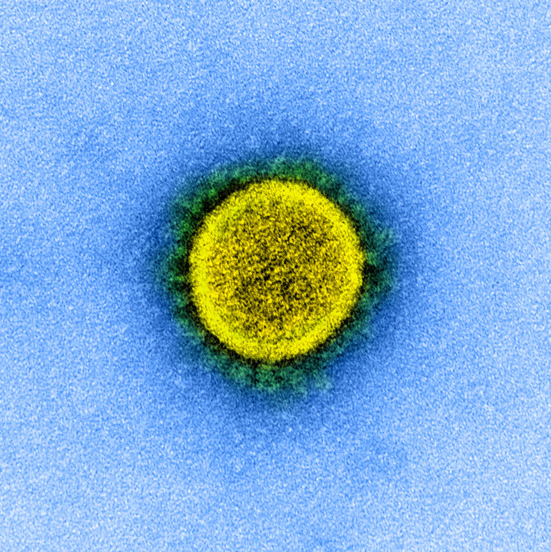 SARS-CoV-2 coronavirus image